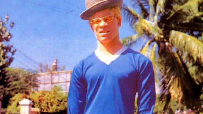 Yellowman Maladie Yellowman Maladie
