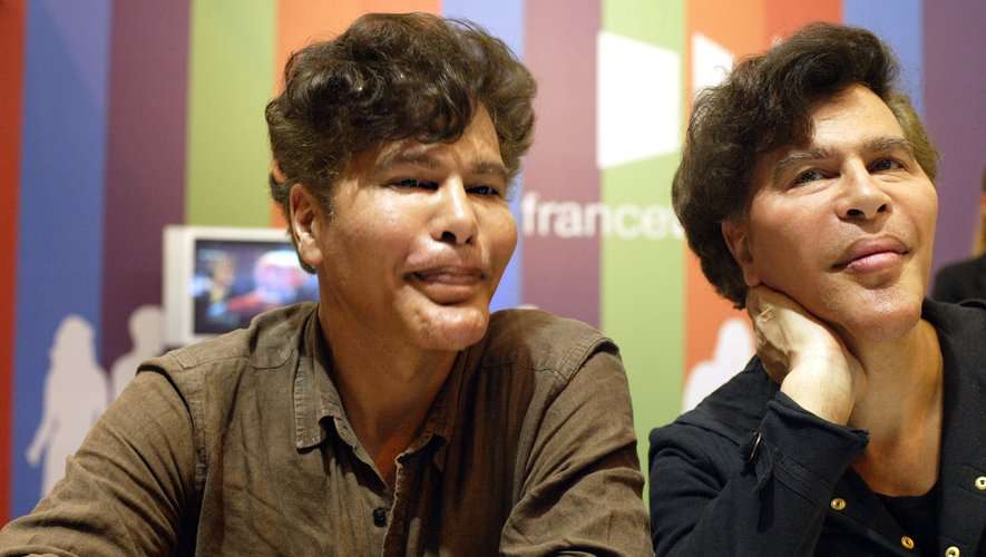 Igor Et Grichka Mort