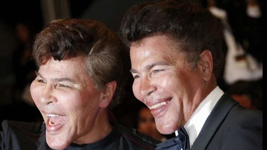 Les Freres Bogdanoff Mort